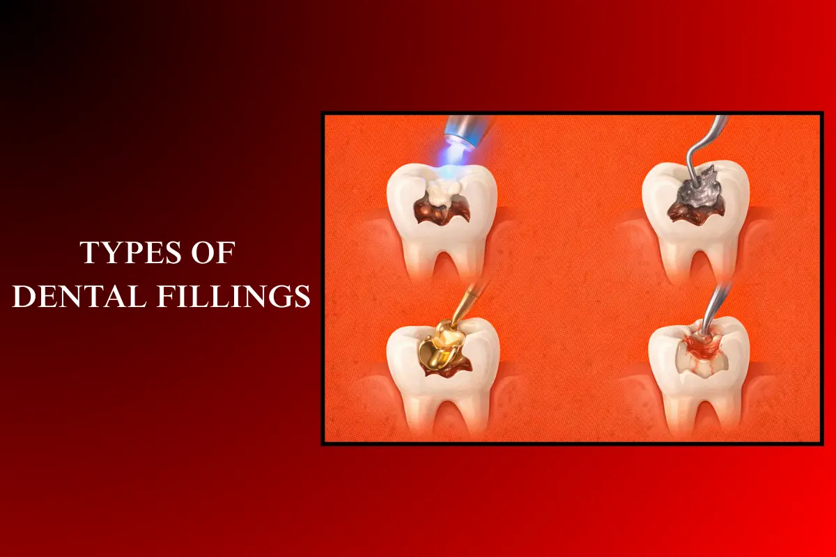 types of dental fillings