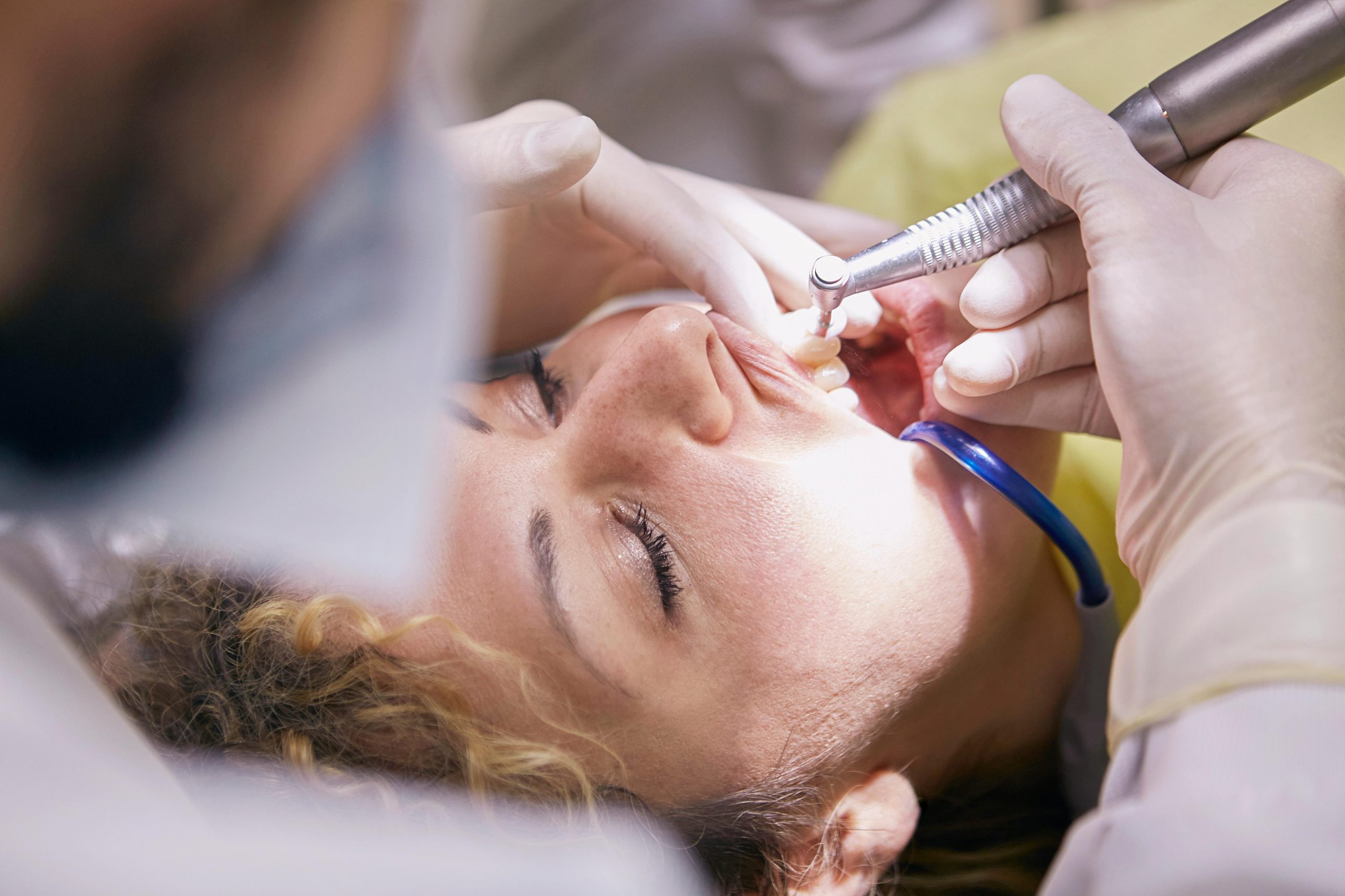 Dental-bridge-procedure