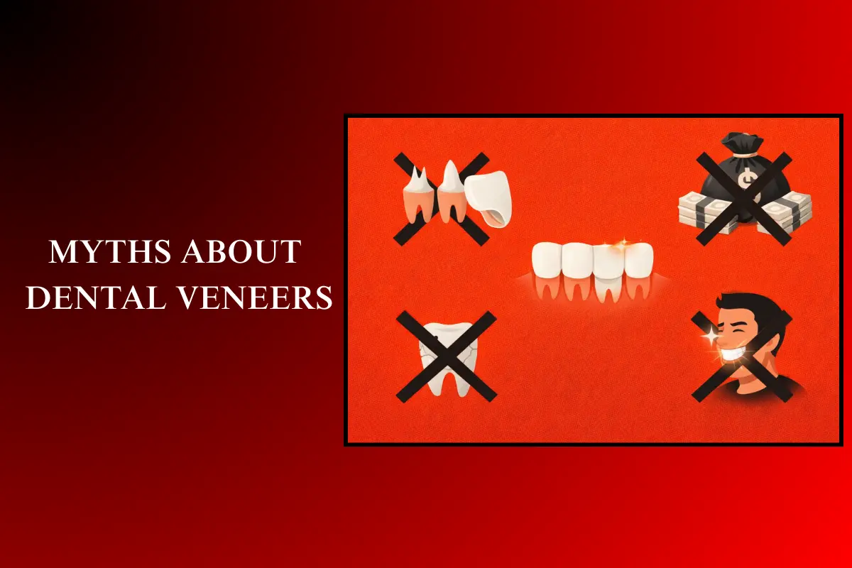 myths about dental veneers