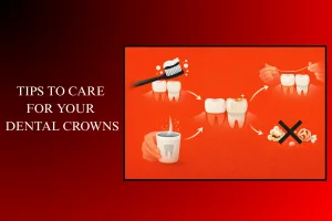 tips to care for your dental crowns
