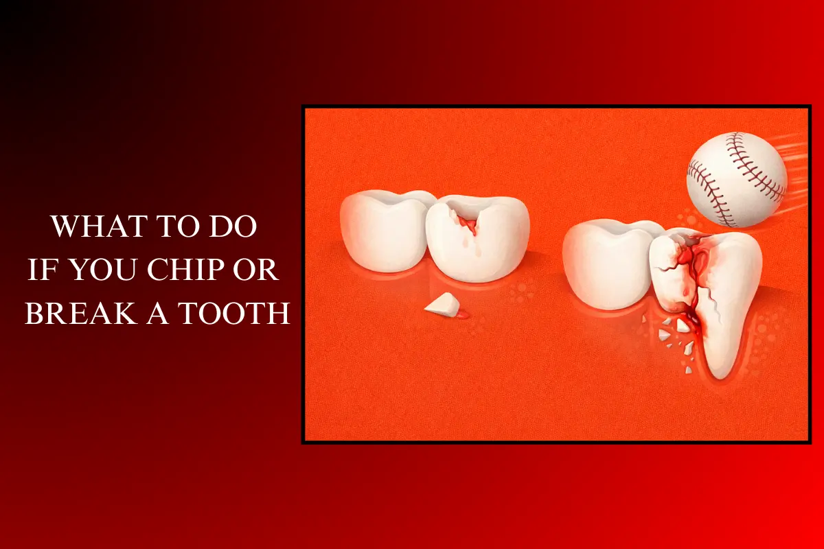 what to do if you chip or break a tooth
