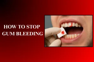 stop-Gum-Bleeding