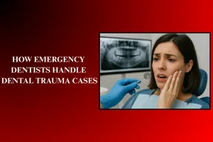Dental Trauma Cases