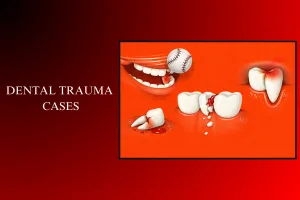 dental trauma cases