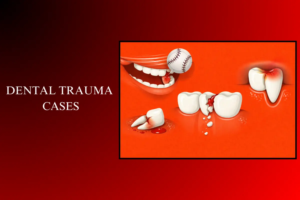 dental trauma cases