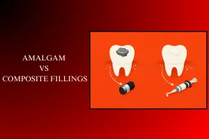 amalgam vs composite fillings