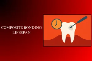 composite bonding lifespan