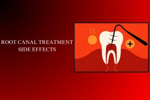root canal treatment side effects