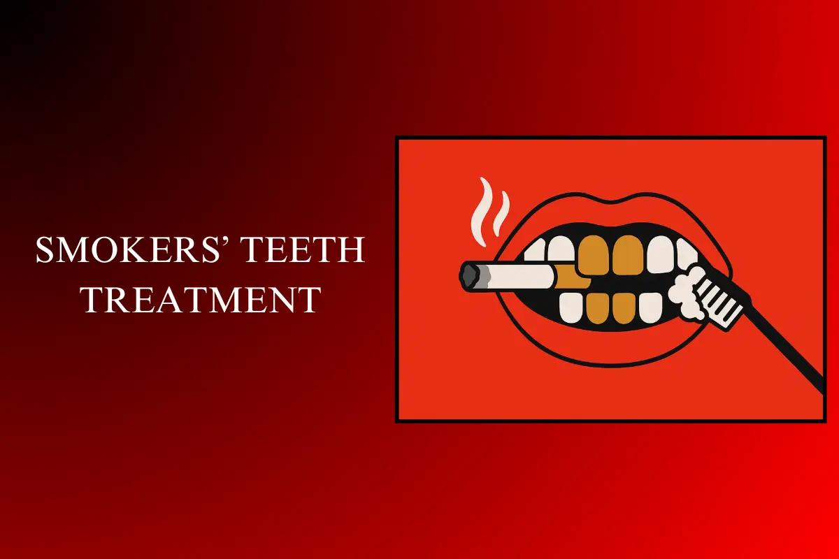 smokers’ teeth treatment