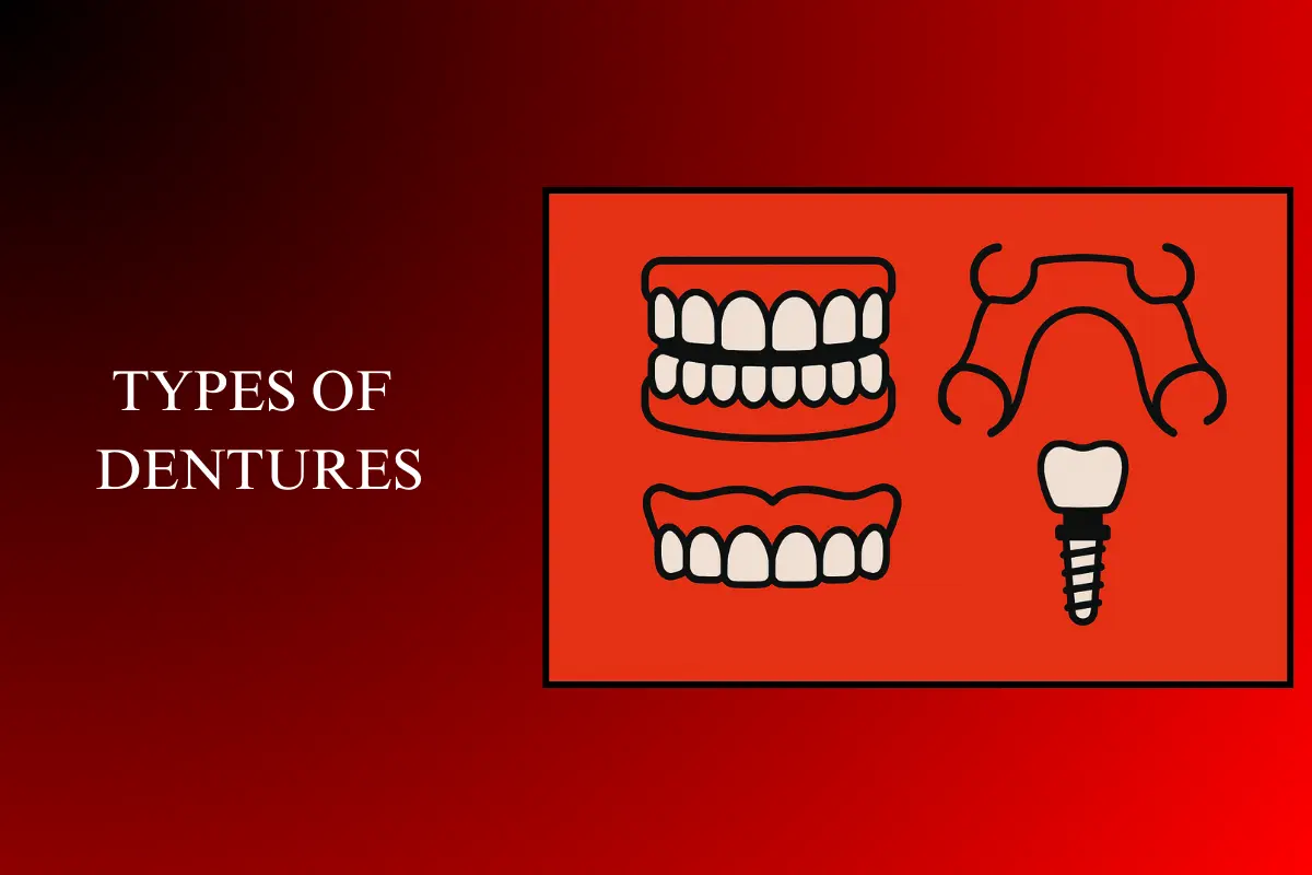 types of dentures
