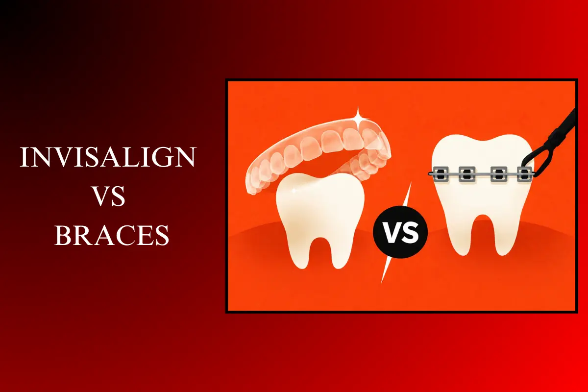 invisalign vs braces