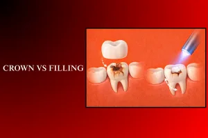 crown vs filling