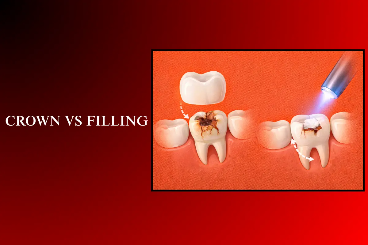crown vs filling