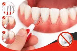 how to use interdental brushes without causing damage