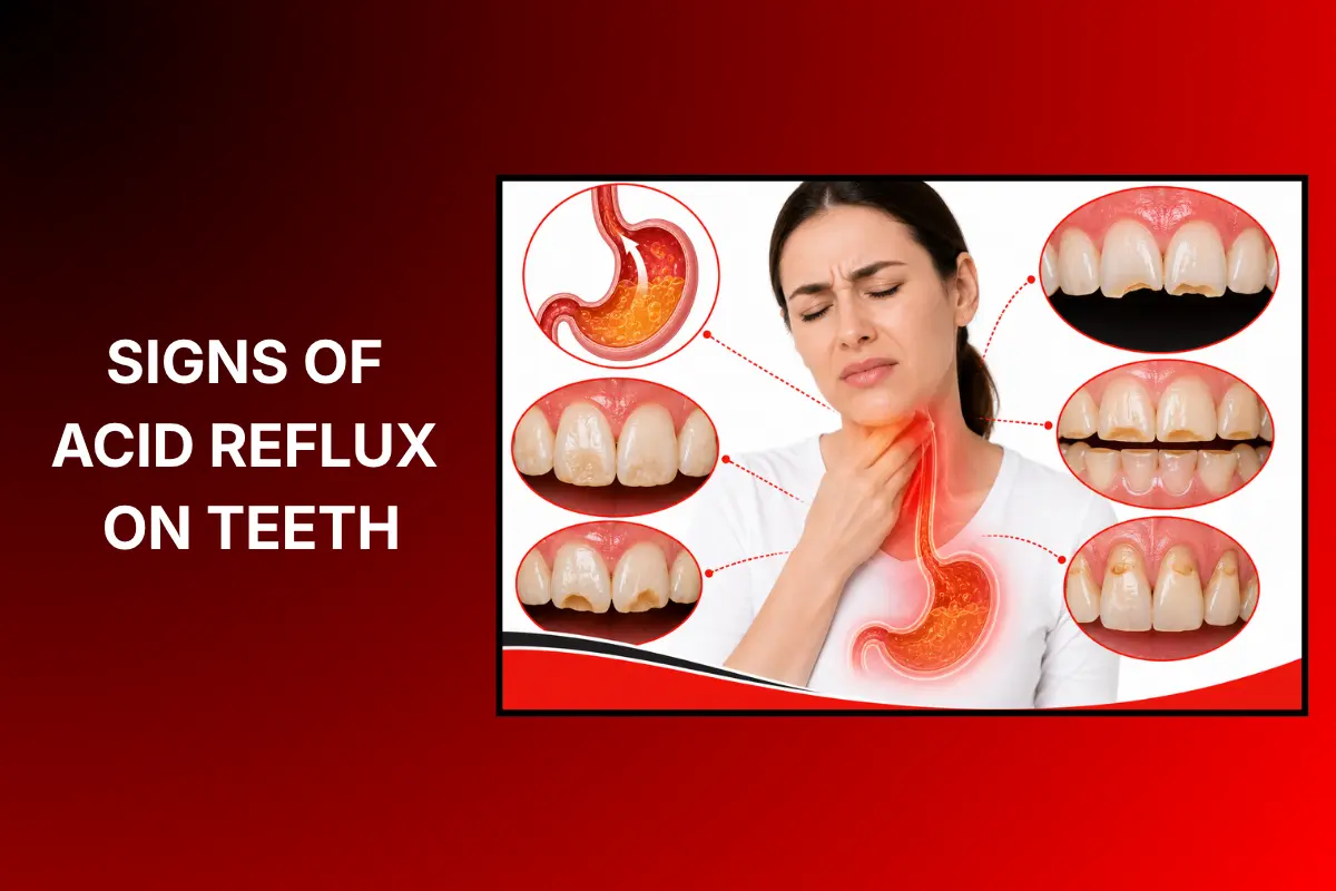 signs of acid reflux on teeth